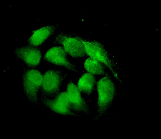 FRA1  Rabbit mAb