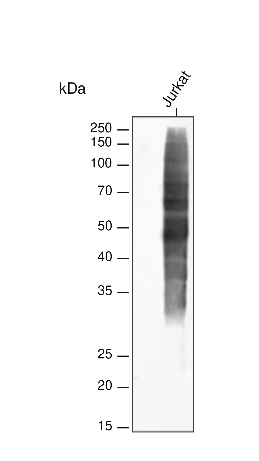 Phospho-Tyrosine  Rabbit mAb