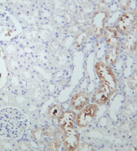 Peroxiredoxin 1 Rabbit mAb