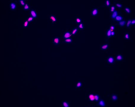 Cyclin E1 Rabbit mAb