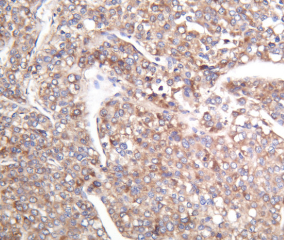 CaMKII &alpha; Rabbit mAb
