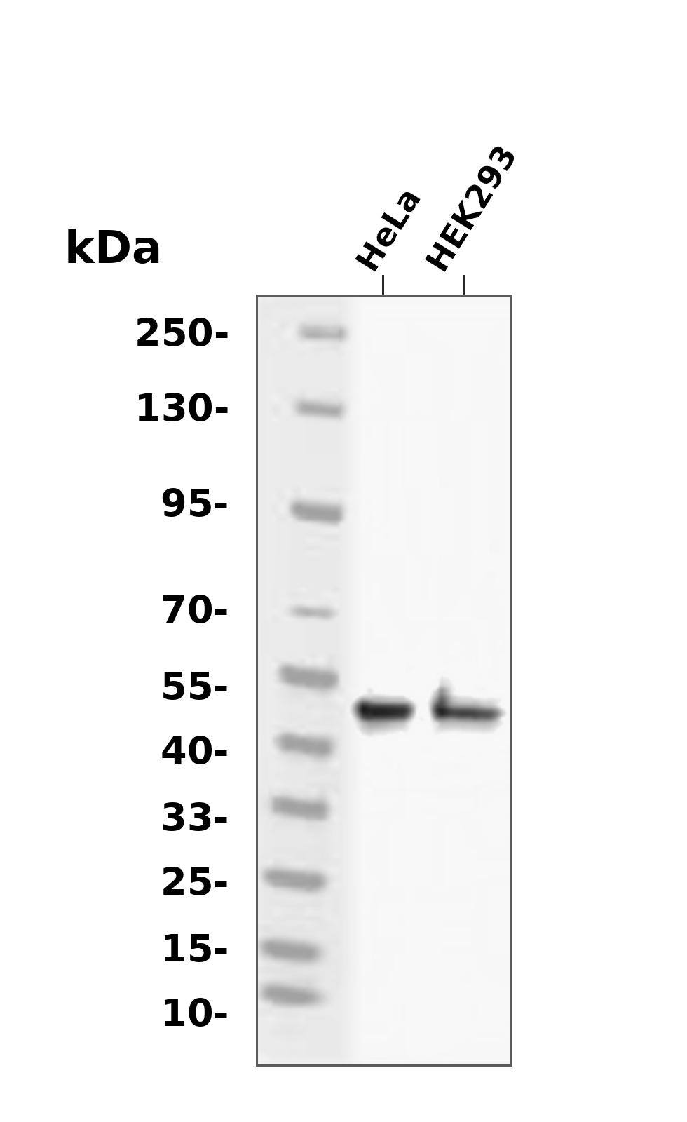 GSK3 beta (Phospho-Ser9) Antibody