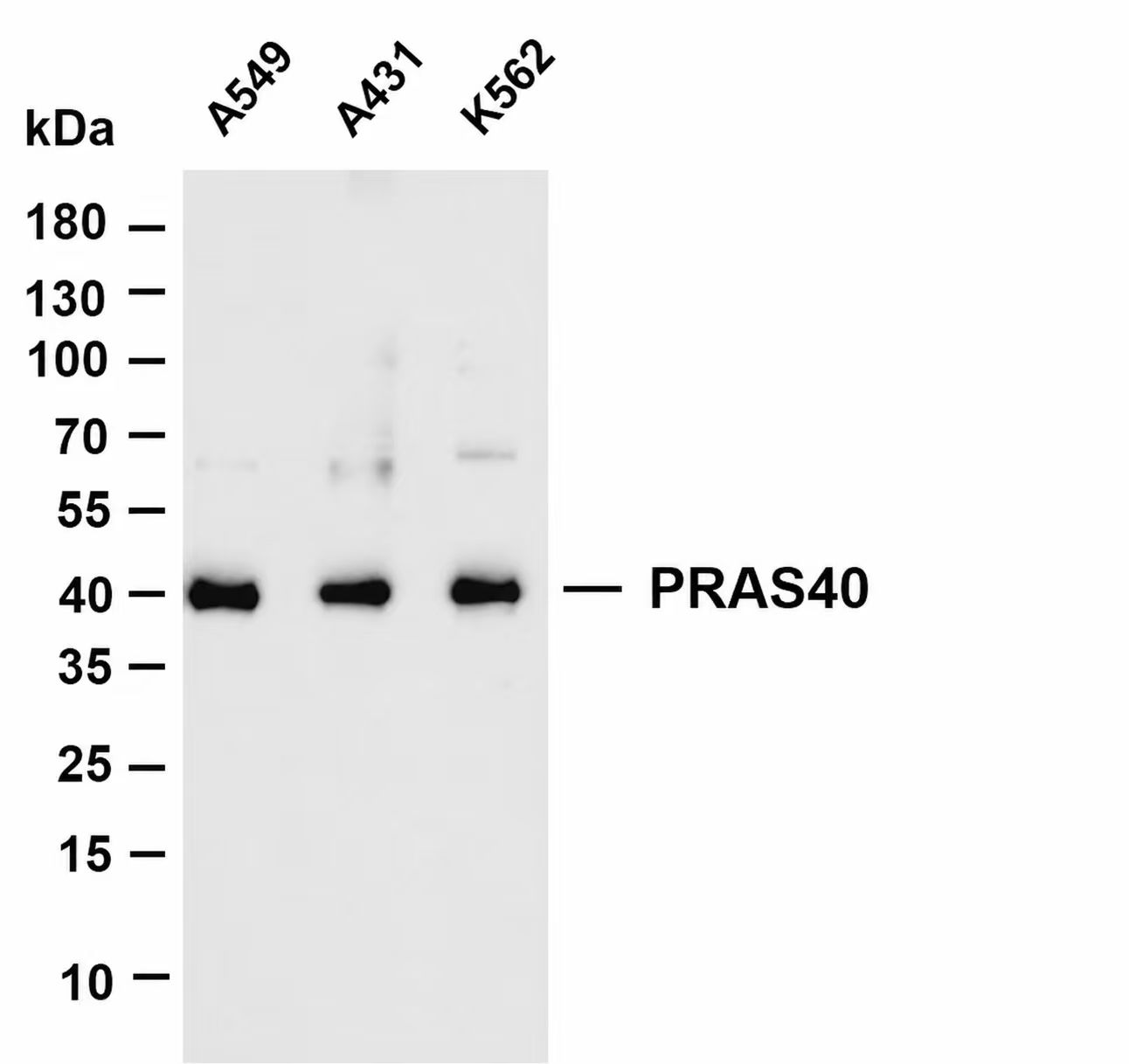 AAY1394