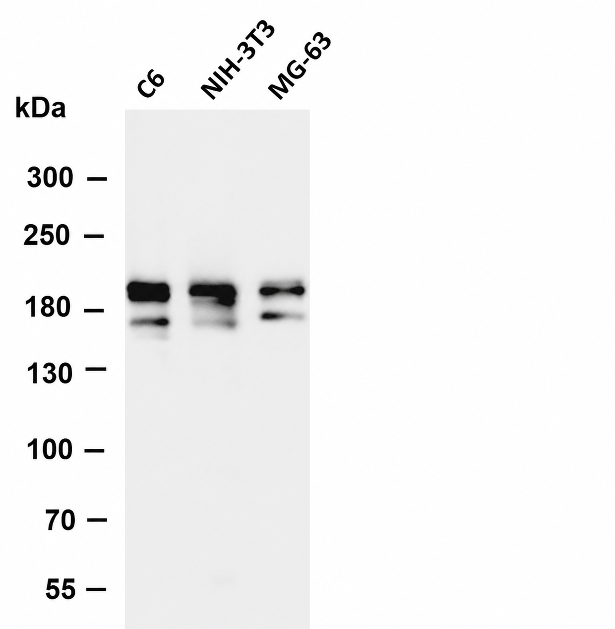 PDGFR-&beta; Rabbit mAb