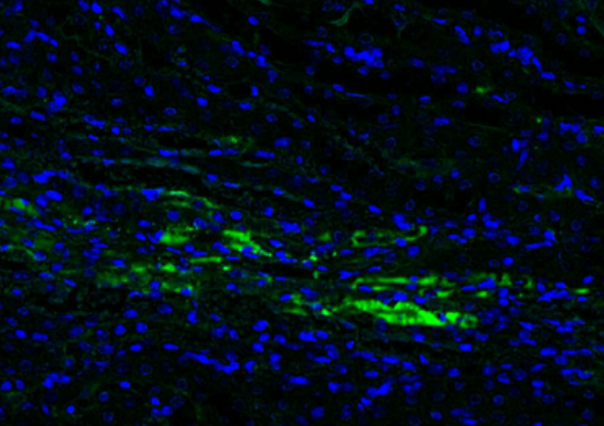 LAMP2 Rabbit mAb