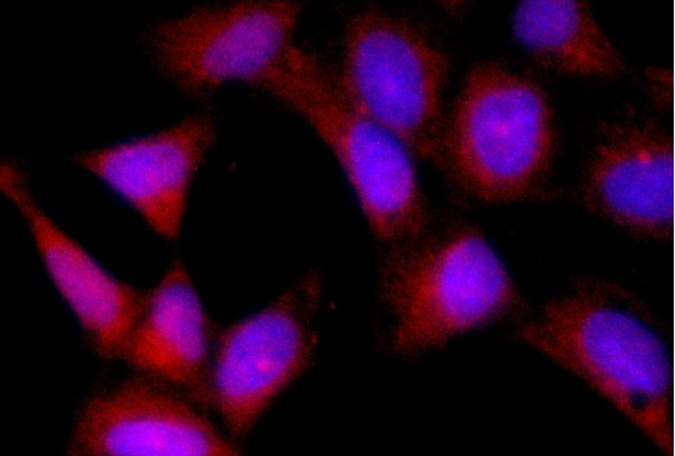 Yes1 Rabbit mAb