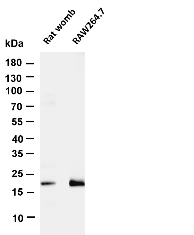 p21 Rabbit mAb