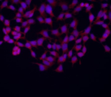 p21 Rabbit mAb