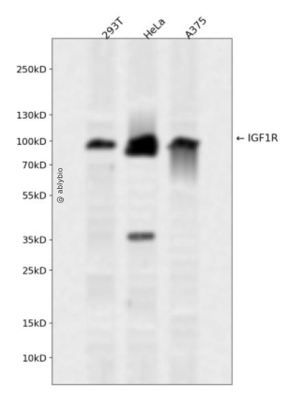 IGF-I receptor beta/Insulin Receptor beta