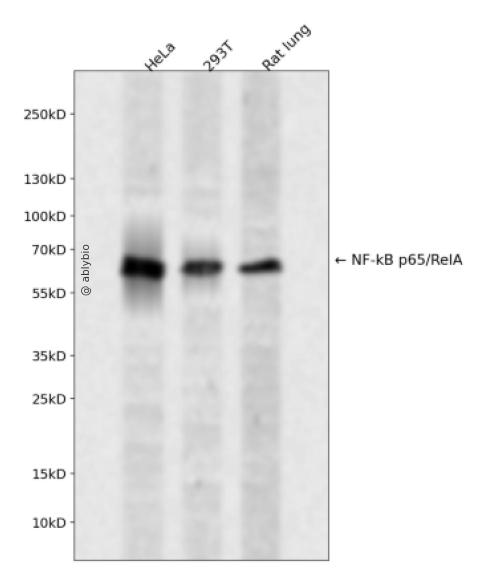 NF-&kappa;B p65 (Phospho-Thr505) Antibody