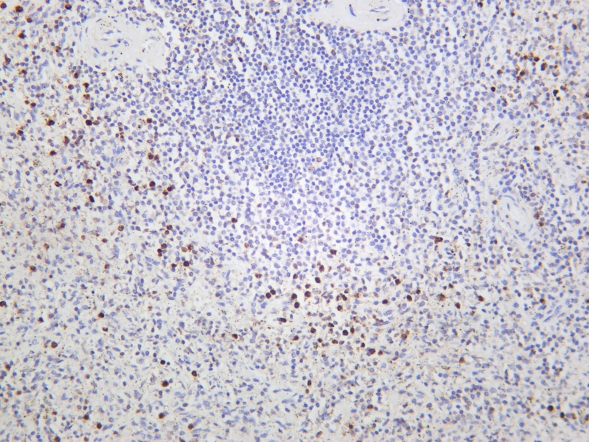 Granzyme B Rabbit mAb