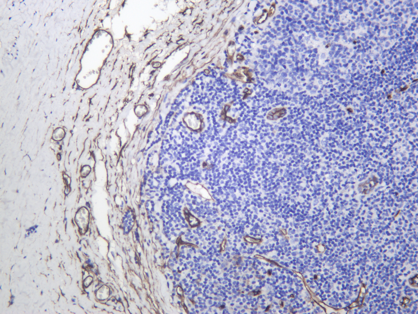 CD34 Rabbit mAb