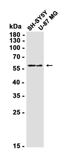 Src Family (Phospho Tyr416) Rabbit mAb