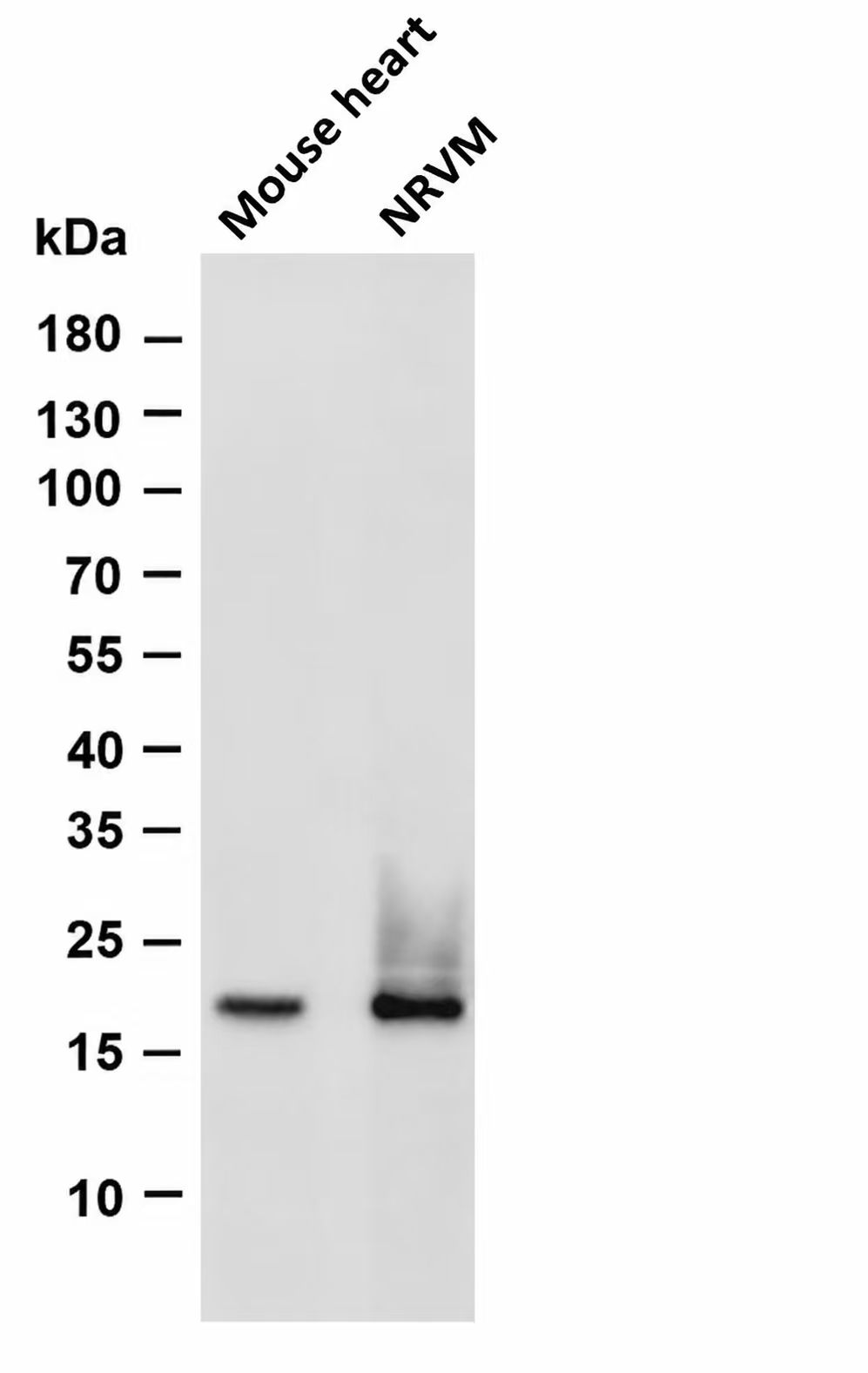 Myosin Light Chain 2 Rabbit mAb