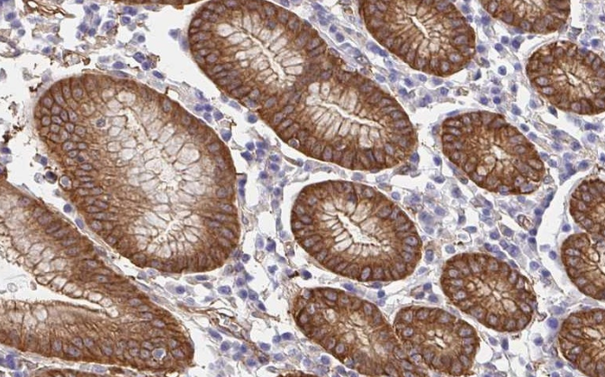 Cortactin Rabbit mAb