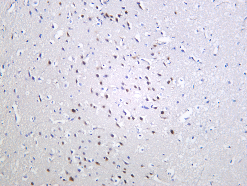 Fos B  Rabbit mAb