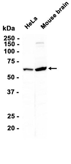 Catalase Rabbit mAb