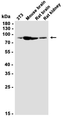 VPS35 Rabbit mAb
