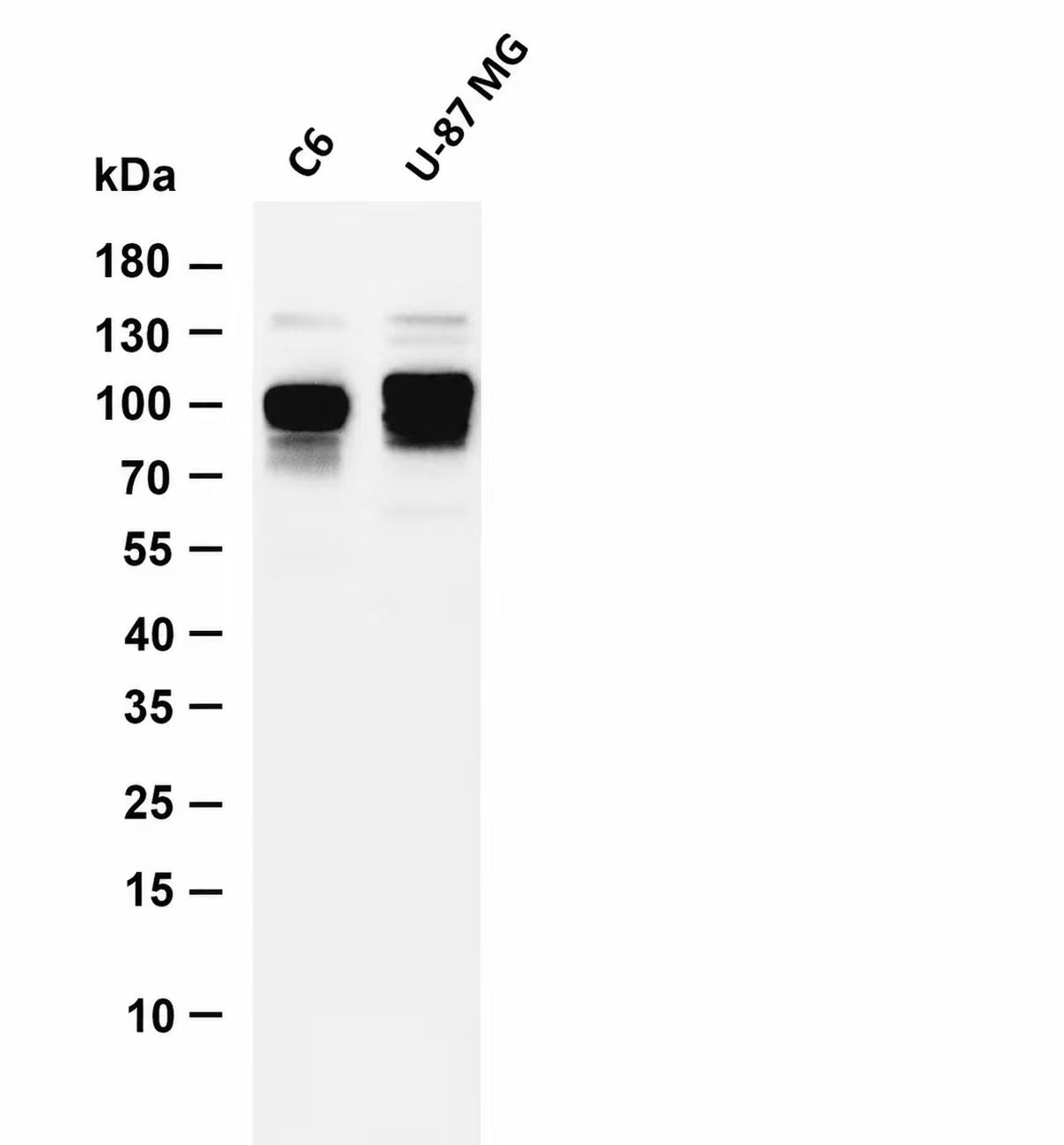 Catenin delta1 Rabbit mAb
