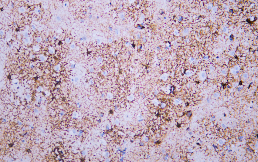 GFAP Mouse mAb