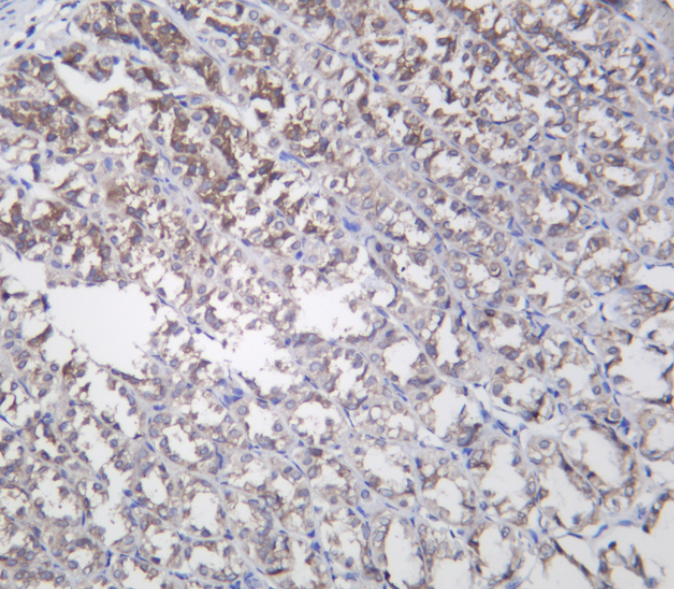 PERK Rabbit mAb