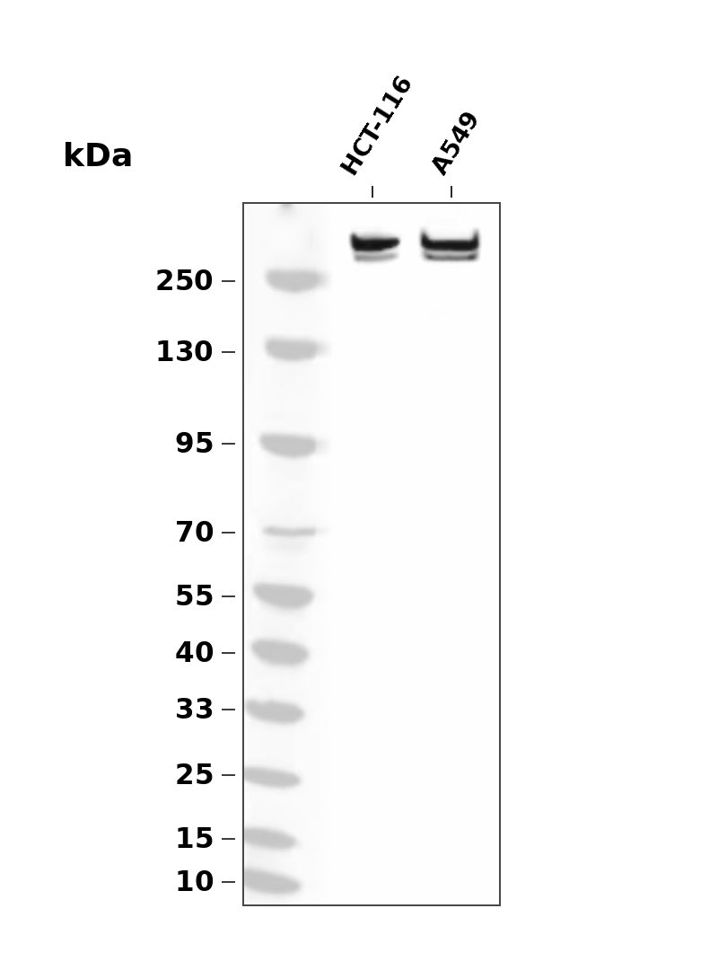 PRPF8 (YD16235) Rabbit mAb