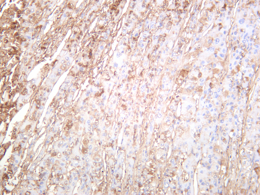 Albumin Rabbit mAb