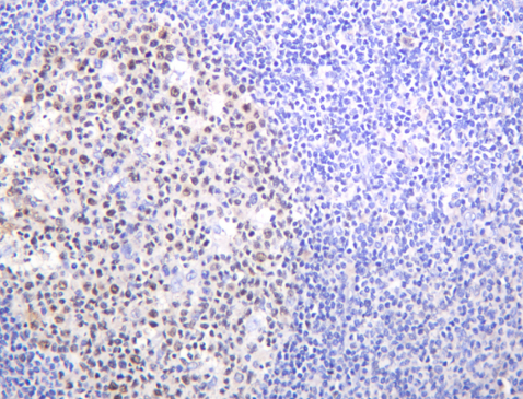Bcl-6 Rabbit mAb