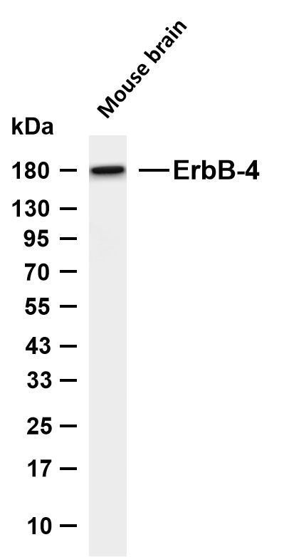 ErbB-4  Rabbit mAb