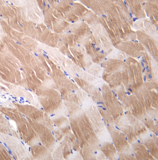 MYH6/7 (YD19907) Rabbit mAb