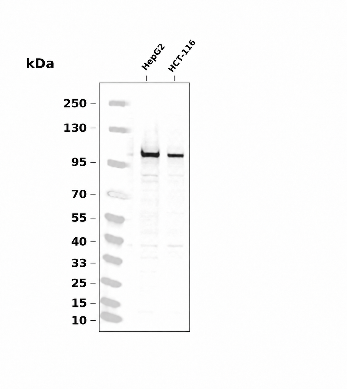 HMGCR Rabbit mAb
