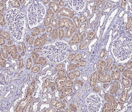 Galectin 7 (YD11808) Rabbit mAb