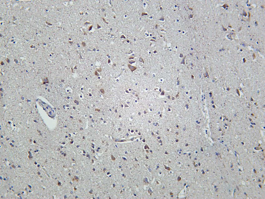 FXR1 Rabbit mAb
