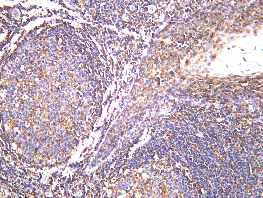 ASC Rabbit mAb