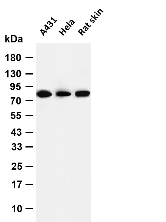 Catenin-&gamma; Rabbit mAb