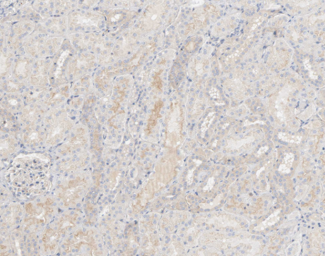 Phospho-Src (Ser17) Antibody