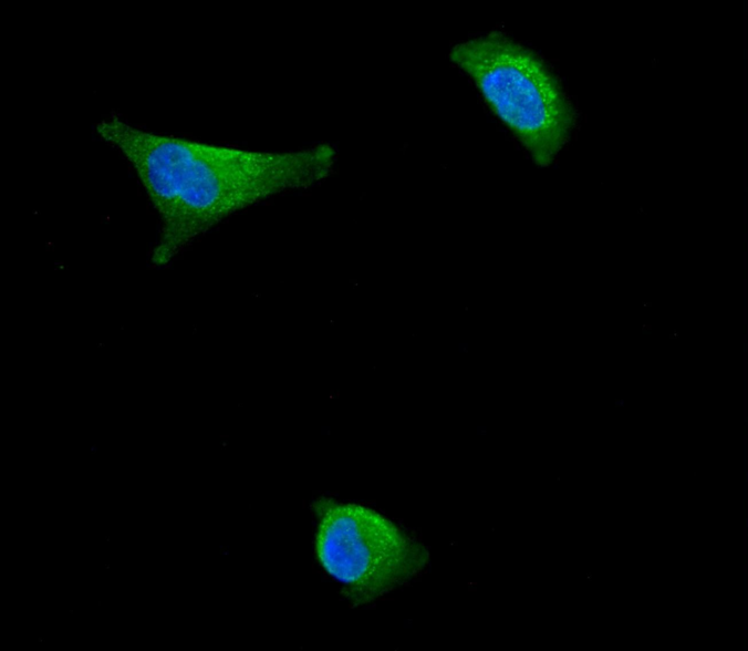 MMP2 Rabbit mAb