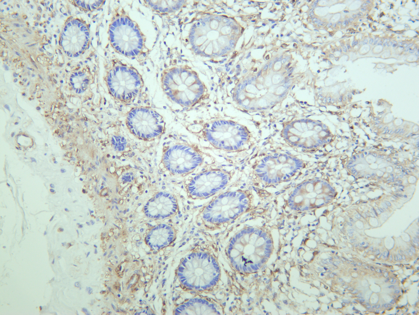 Vinculin Rabbit mAb