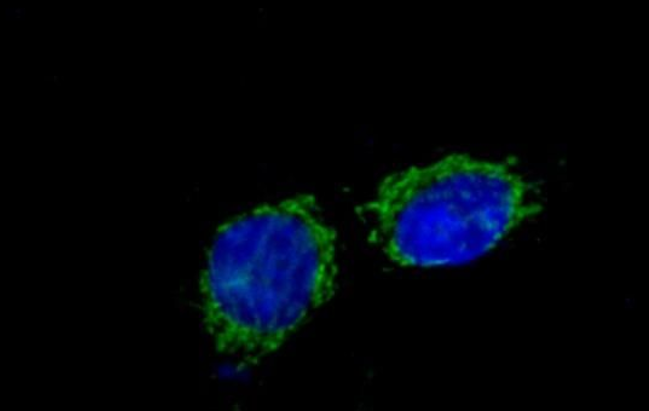 TMEM16A  Rabbit mAb