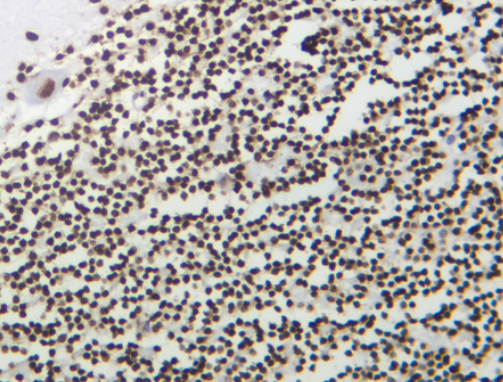 Histone H3 (Tri Methyl Lys9)  Rabbit mAb