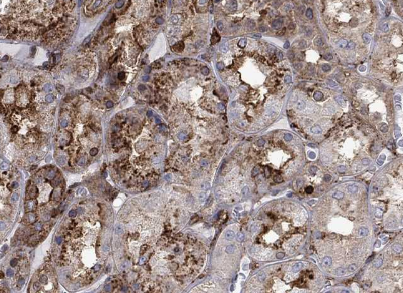 Urokinase (YD13804) Rabbit mAb