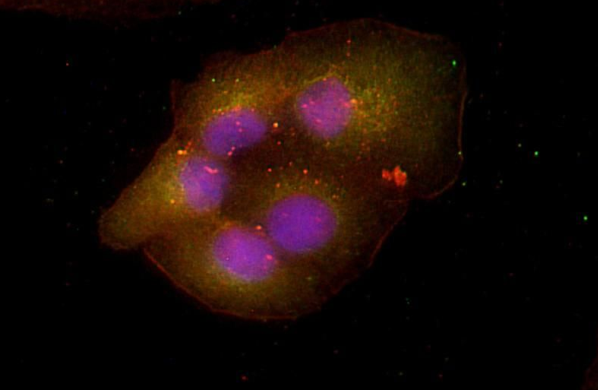 CCL3 (YD35353) Rabbit mAb