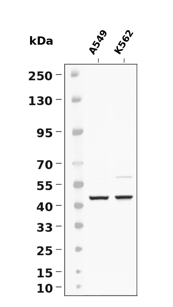 SLC16A3/MCT4 Rabbit mAb