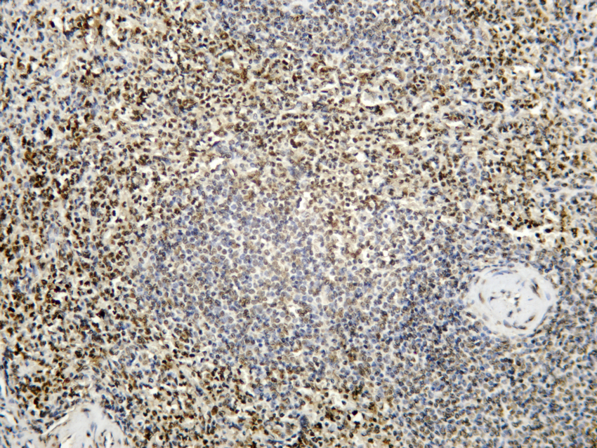 Histone H3 (Di Methyl Lys36)  Rabbit mAb