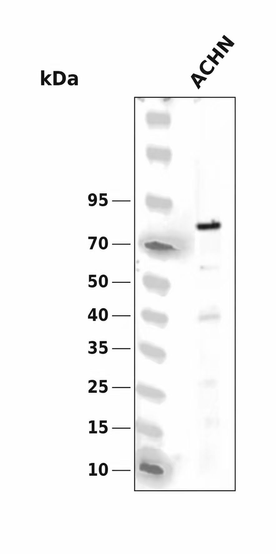 COL23A1 Antibody