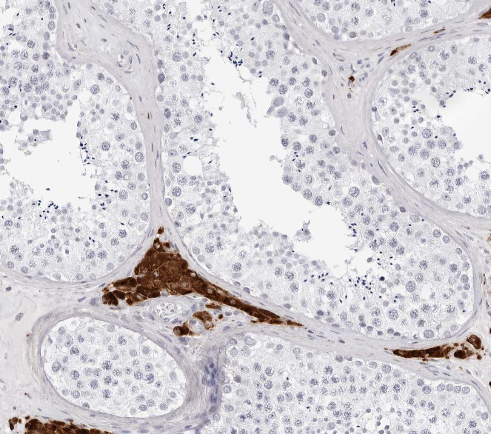 INSL3 (YD31488) Rabbit mAb