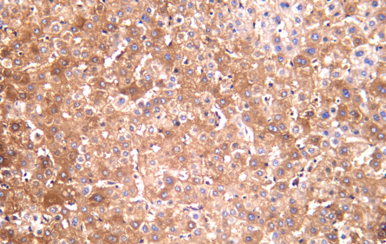 IRS2 Rabbit mAb