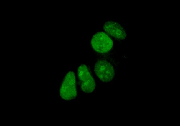 Citrulline-Histone H3 (Arg17) (YD15877) Rabbit mAb