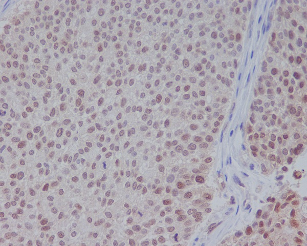 ERK 1/2 Mouse mAb