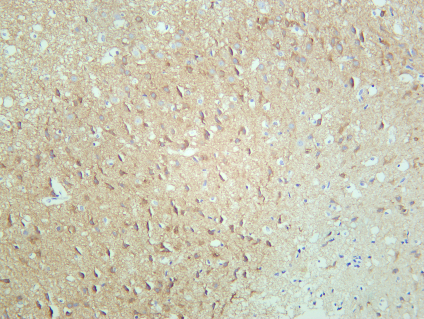 Glutamate Receptor 1 Rabbit mAb